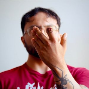 Los Angeles Police Blew Off My Finger for Protesting ICE