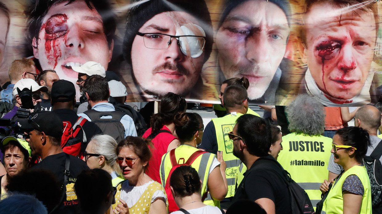 ‘March of the Wounded’ marks 29th week of Yellow Vests protests