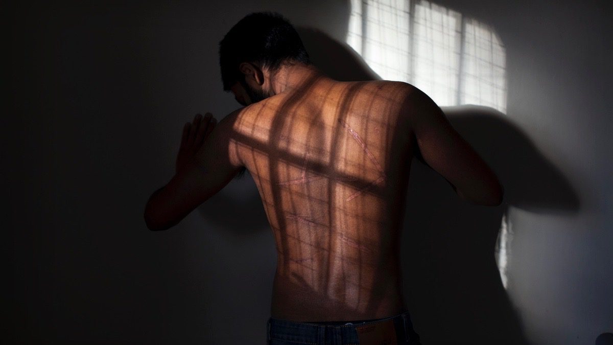 Sri Lanka Tamils tortured