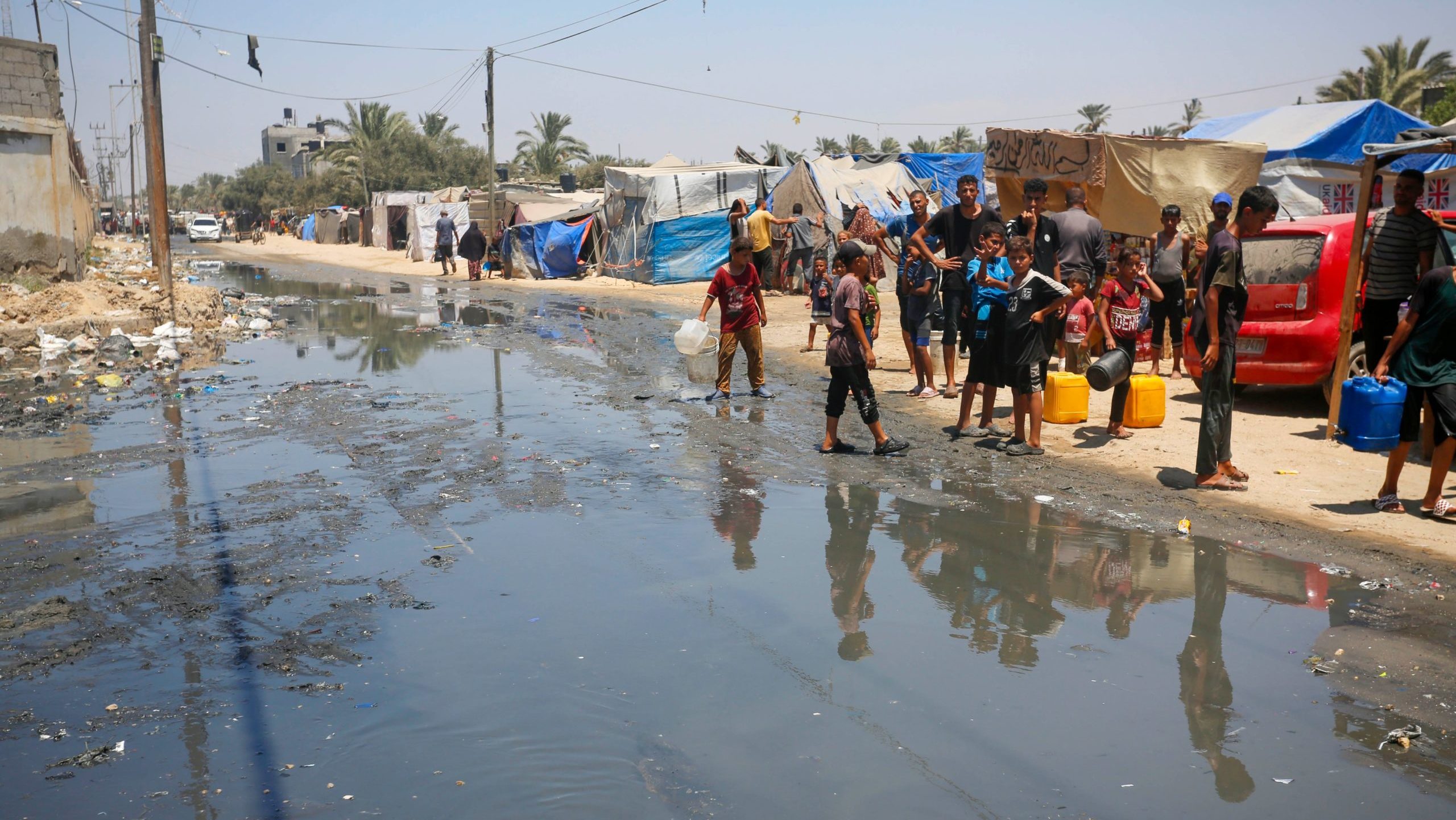 Skin infections in Gaza skyrocket